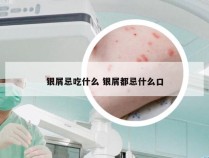 银屑忌吃什么 银屑都忌什么口