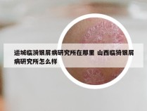 运城临漪银屑病研究所在那里 山西临猗银屑病研究所怎么样