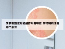 生物制剂注射的副作用有哪些 生物制剂注射哪个部位