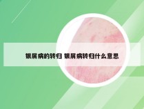 银屑病的转归 银屑病转归什么意思