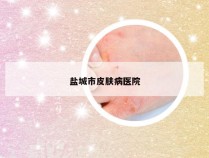 盐城市皮肤病医院