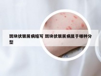 斑块状银屑病缩写 斑块状银屑病属于哪种分型