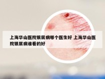 上海华山医院银屑病哪个医生好 上海华山医院银屑病谁看的好