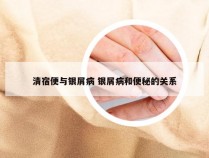 清宿便与银屑病 银屑病和便秘的关系