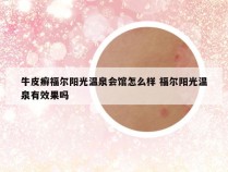 牛皮癣福尔阳光温泉会馆怎么样 福尔阳光温泉有效果吗