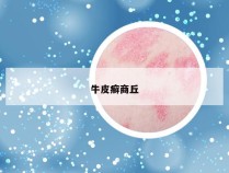 牛皮癣商丘