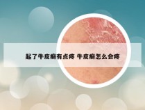 起了牛皮癣有点疼 牛皮癣怎么会疼
