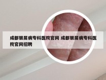 成都银屑病专科医院官网 成都银屑病专科医院官网招聘