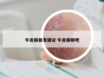 牛皮癣朋发建议 牛皮癣聊吧