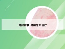 鼻藓症状 鼻癣怎么治疗