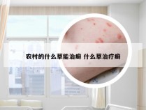 农村的什么草能治癣 什么草治疗癣