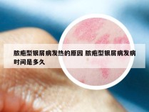脓疱型银屑病发热的原因 脓疱型银屑病发病时间是多久