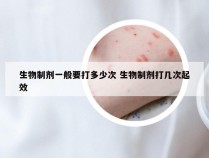 生物制剂一般要打多少次 生物制剂打几次起效