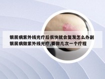 银屑病紫外线光疗后很快就会复发怎么办副 银屑病做紫外线光疗,要做几次一个疗程