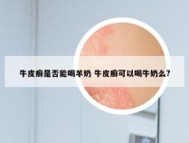 牛皮癣是否能喝羊奶 牛皮癣可以喝牛奶么?