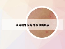 疫苗治牛皮癣 牛皮肤癣疫苗