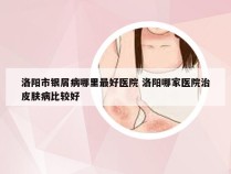 洛阳市银屑病哪里最好医院 洛阳哪家医院治皮肤病比较好