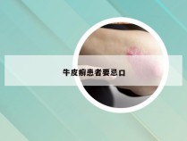 牛皮癣患者要忌口