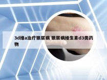 3d维a治疗银屑病 银屑病维生素d3类药物