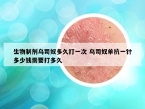 生物制剂乌司奴多久打一次 乌司奴单抗一针多少钱需要打多久