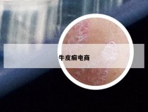 牛皮癣电商