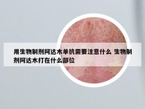 用生物制剂阿达木单抗需要注意什么 生物制剂阿达木打在什么部位