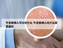 牛皮癣病人可以吃什么 牛皮癣病人吃什么蔬菜最好