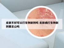 皮肤不好可以打生物制剂吗 皮肤病打生物制剂要忌口吗