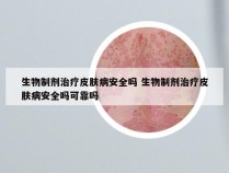 生物制剂治疗皮肤病安全吗 生物制剂治疗皮肤病安全吗可靠吗