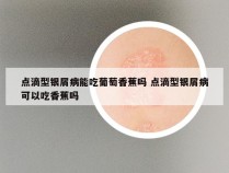点滴型银屑病能吃葡萄香蕉吗 点滴型银屑病可以吃香蕉吗