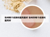 徐州哪个皮肤科医院最好 徐州市哪个皮肤科医院好