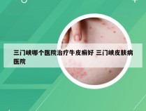 三门峡哪个医院治疗牛皮癣好 三门峡皮肤病医院