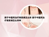 西宁中医院治疗银屑病怎么样 西宁中医院治疗银屑病怎么样啊