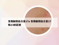 生物制剂白介素17a 生物制剂白介素17和23的区别