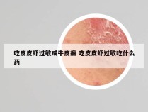 吃皮皮虾过敏成牛皮癣 吃皮皮虾过敏吃什么药