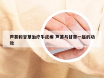 芦荟和甘草治疗牛皮癣 芦荟与甘草一起的功效