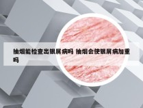 抽烟能检查出银屑病吗 抽烟会使银屑病加重吗