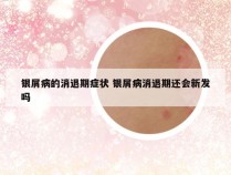 银屑病的消退期症状 银屑病消退期还会新发吗