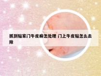 抓到贴家门牛皮癣怎处理 门上牛皮贴怎么去除