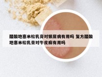 醋酸地塞米松乳膏对银屑病有用吗 复方醋酸地塞米松乳膏对牛皮癣有用吗