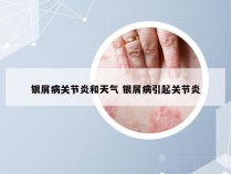 银屑病关节炎和天气 银屑病引起关节炎