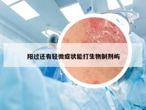 阳过还有轻微症状能打生物制剂屿