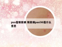 pso是银屑病 银屑病pasi90是什么意思