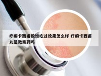 疗癣卡西甫散谁吃过效果怎么样 疗癣卡西甫丸是激素药吗
