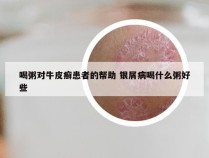 喝粥对牛皮癣患者的帮助 银屑病喝什么粥好些
