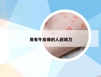 用有牛皮癣的人刮胡刀