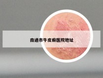 南通市牛皮癣医院地址