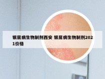 银屑病生物制剂西安 银屑病生物制剂2021价格