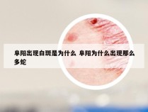 阜阳出现白斑是为什么 阜阳为什么出现那么多蛇