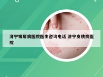 济宁银屑病医院医生咨询电话 济宁皮肤病医院